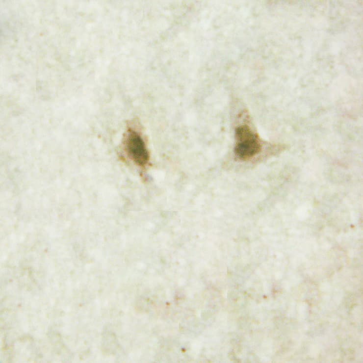 GNAL Antibody