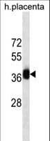 GBX2 Antibody (aa103-131)