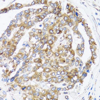Polyclonal Rabbit anti-Human BAP29 / BCAP29 Antibody (IHC, WB)