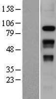 SLFN12 Protein (Over-Expression Lysate Myc-DDK (Flag))