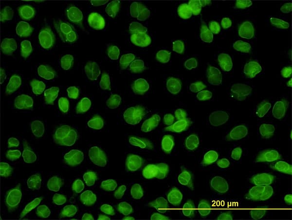 EMD / Emerin Antibody (clone 3B9)