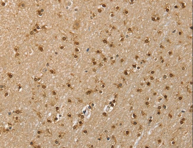RNH1 Antibody
