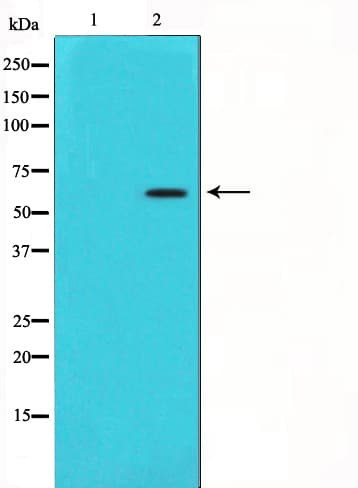 AKT1 Antibody (phospho-Ser473)