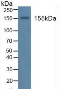 INSR / Insulin Receptor Antibody (aa1027-1364)