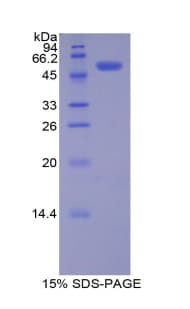 Mouse PDGF-BB Protein (Recombinant His-GST)