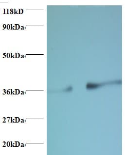 PTDSS1 Antibody