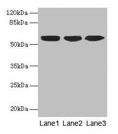 IHC-plus™ KRT10 / CK10 / Cytokeratin 10 Antibody (aa1-584)