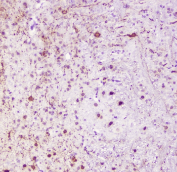 CALB1 / Calbindin Antibody