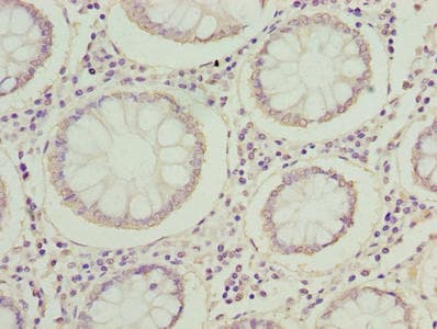 MRPL14 Antibody
