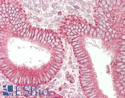 IHC-plus™ SFRP4 Antibody