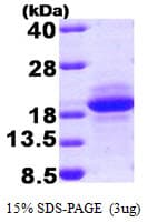 Human MCFD2 Protein (Recombinant)