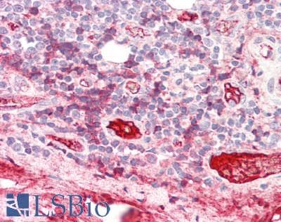 Complement C3 / C3b Antibody (clone 013III-1.16)