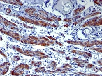 CALD1 / Caldesmon Antibody (clone h-CALD)