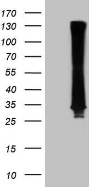 Monoclonal Mouse anti-Human RAB3A Antibody (clone OTI6D10, WB)