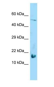 LGALS7 / Galectin 7 Antibody (aa55-104)