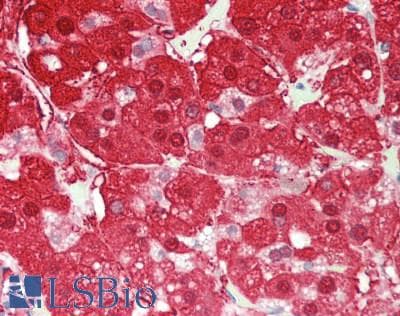 IHC-plus™ AKR1B10 Antibody (aa1-316)