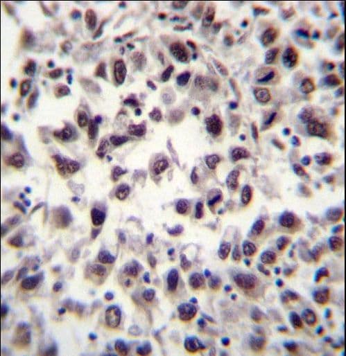 Polyclonal Rabbit anti-Human SFRS7 / 9G8 Antibody (aa69-98, IHC, WB)
