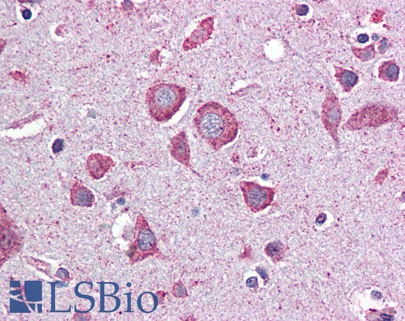 IHC-plus™ Monoclonal Mouse anti-Human EIF2B2 Antibody (clone 5B12-E10, IHC, WB)