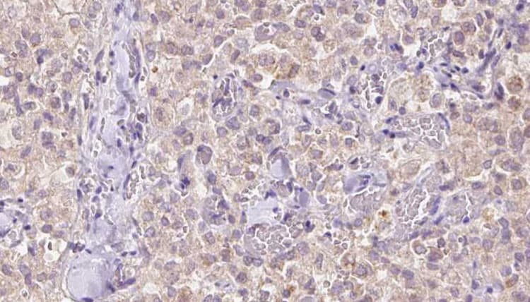 VDAC3 Antibody
