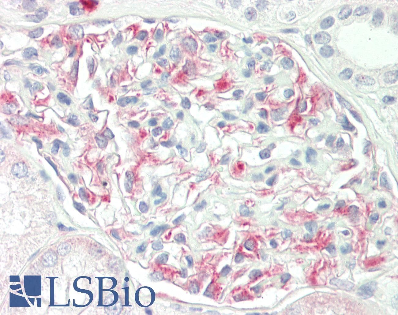 IHC-plus™ Polyclonal Rabbit anti-Human GUCY1A1 / GUCY1A3 Antibody (aa374-423, IHC, WB)