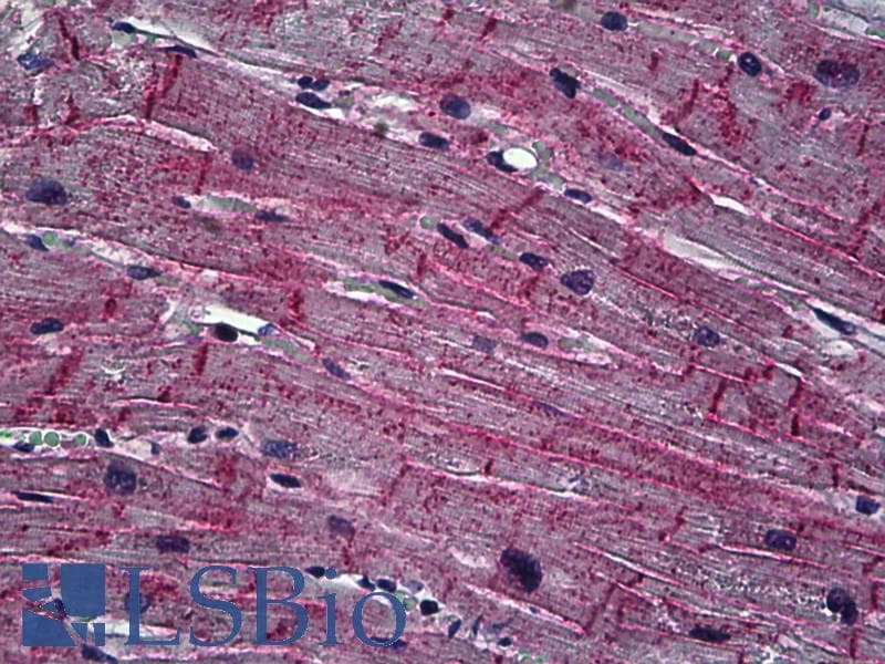 IHC-plus™ Dysferlin Antibody (C-Terminus)