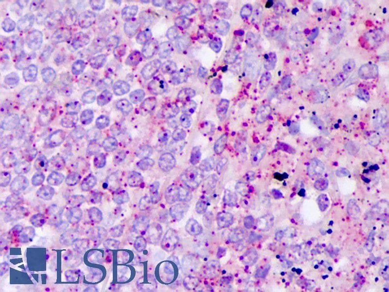 IHC-plus™ IL17A Antibody
