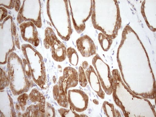 SHMT / SHMT2 Antibody (clone OTI3E9)