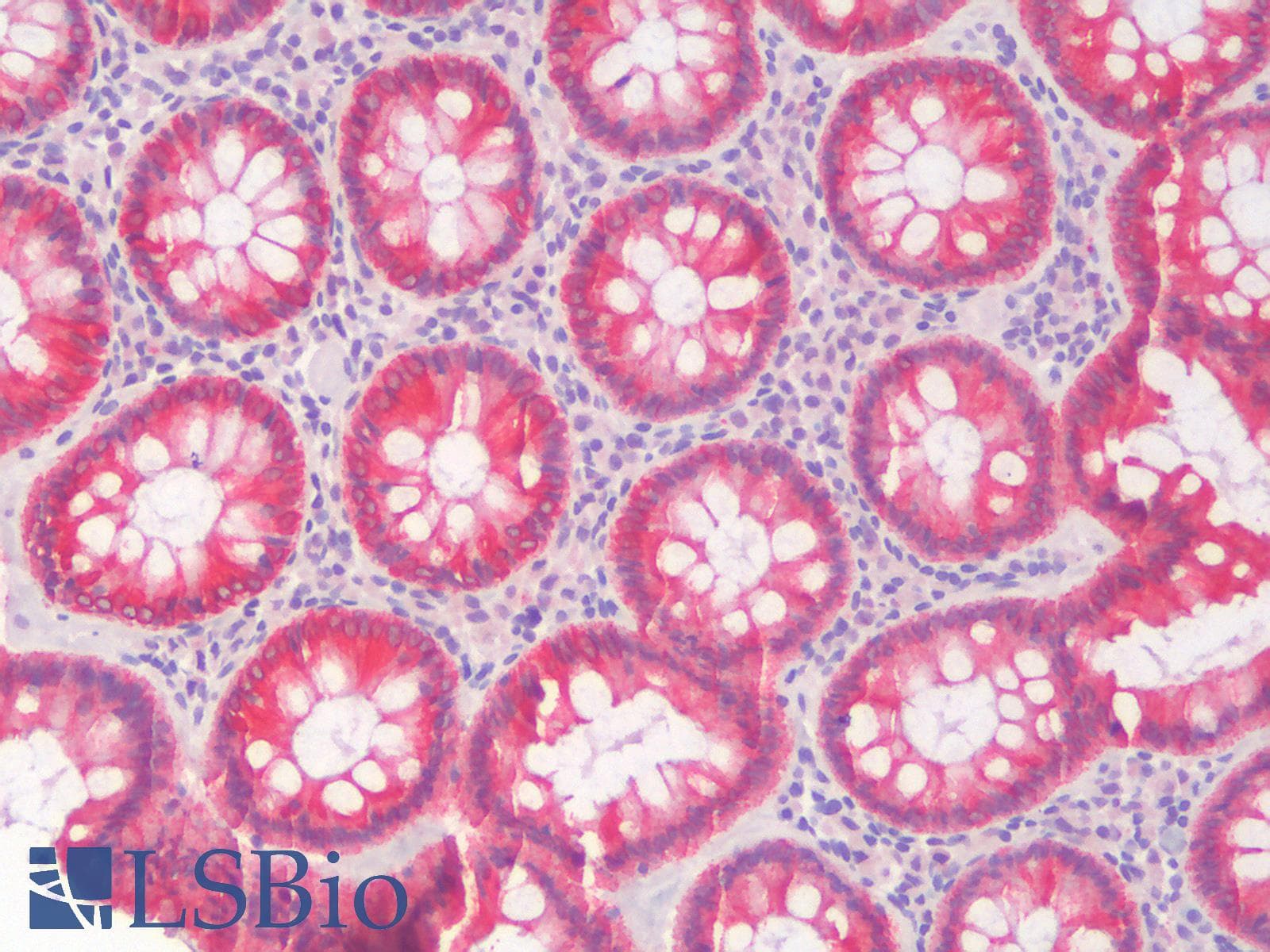PathPlus™ KRT8 / CK8 / Cytokeratin 8 Antibody