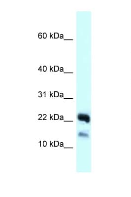 NDUFB10 Antibody (C-Terminus)