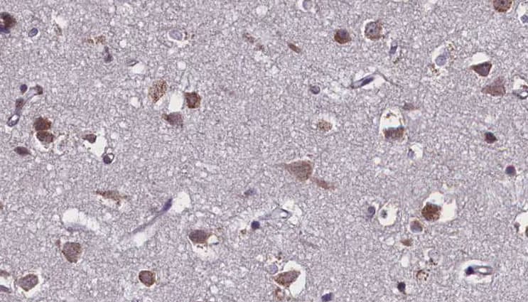 Polyclonal Rabbit anti-Human SLC28A2 Antibody (IHC, IF, WB)