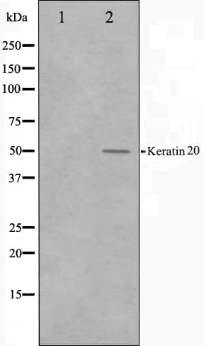 Polyclonal Rabbit anti-Human KRT20 / CK20 / Cytokeratin 20 Antibody (IHC, IF, WB)