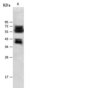 CLU / Clusterin Antibody (Preservative Free)