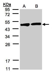 IHC-plus™ CKB / Creatine Kinase BB Antibody (aa165-381)