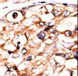 PGK2 Antibody (aa117-145)