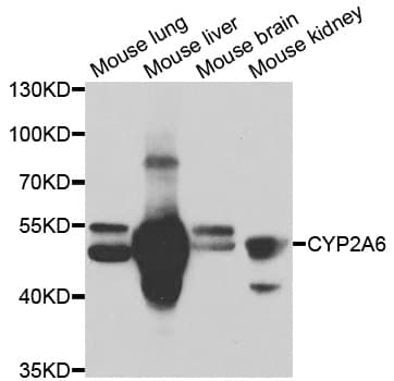 CYP2A6 Antibody
