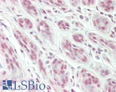 IHC-plus™ Polyclonal Rabbit anti-Human SNRPD3 Antibody (aa1-50, IHC, WB)