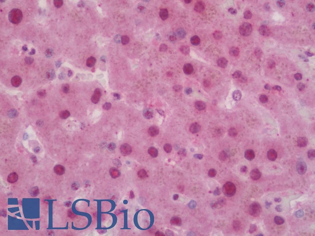 IHC-plus™ Polyclonal Rabbit anti-Human NRP1 / Neuropilin 1 Antibody (aa476-525, IHC, WB)