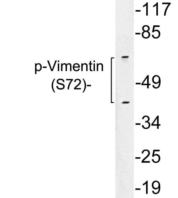 Vimentin Antibody (phospho-Ser72)