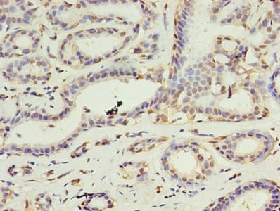 DAPK2 / DAP Kinase 2 Antibody (aa222-370)