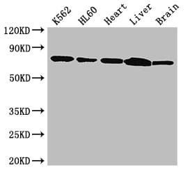 BTK Antibody