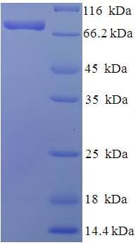 Human PGM3 Protein (Recombinant His-SUMO)