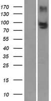 Human ABCC4 / MRP4 Protein (Over-Expression Lysate Myc-DDK (Flag))