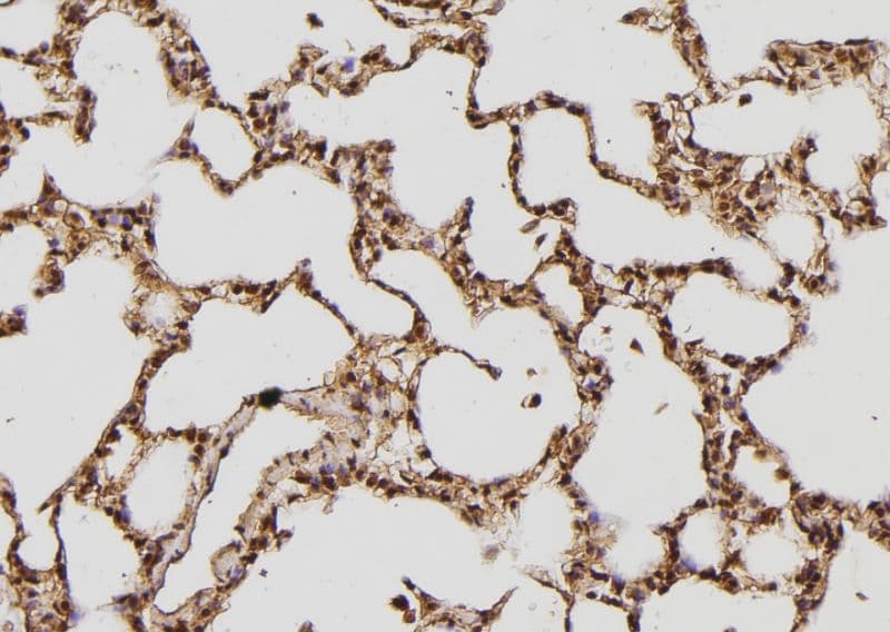 PRKAB1 / AMPK Beta 1 Antibody