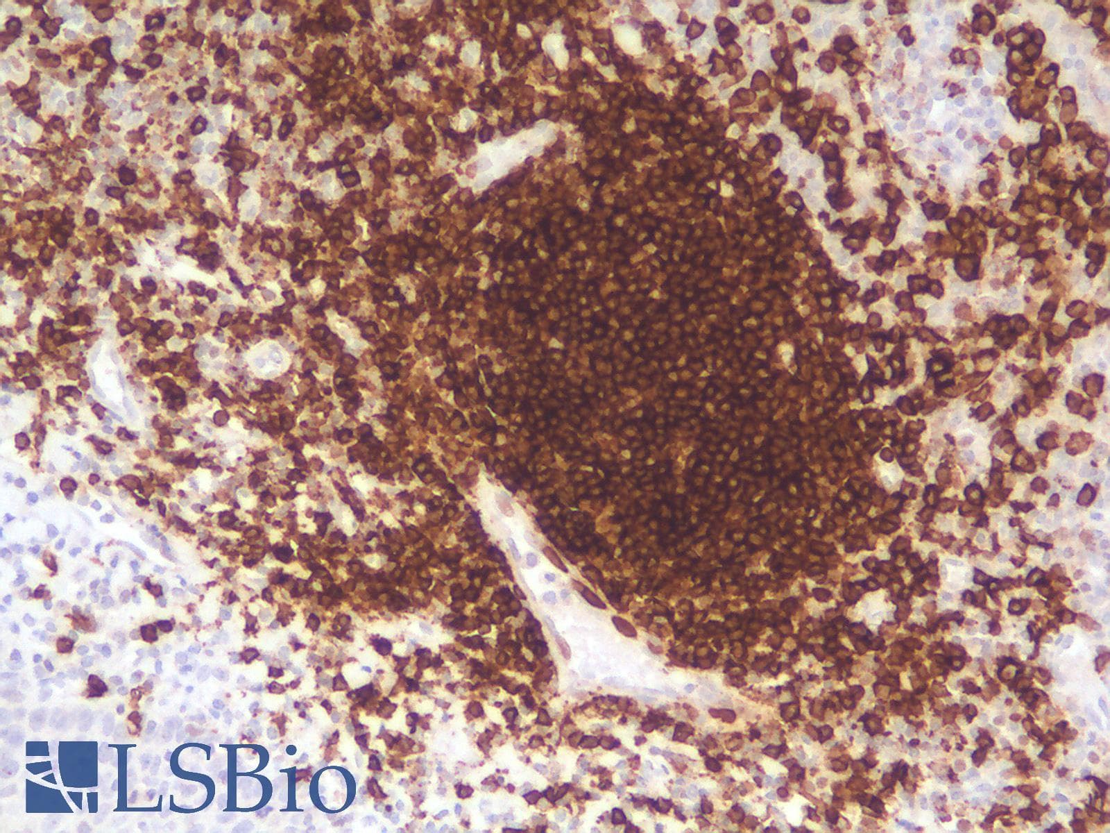 PathPlus™ CD20 Antibody (clone rIGEL/773)