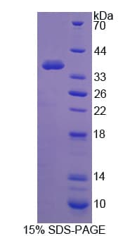 Rat GSK3A / GSK3 Alpha Protein (Recombinant His)