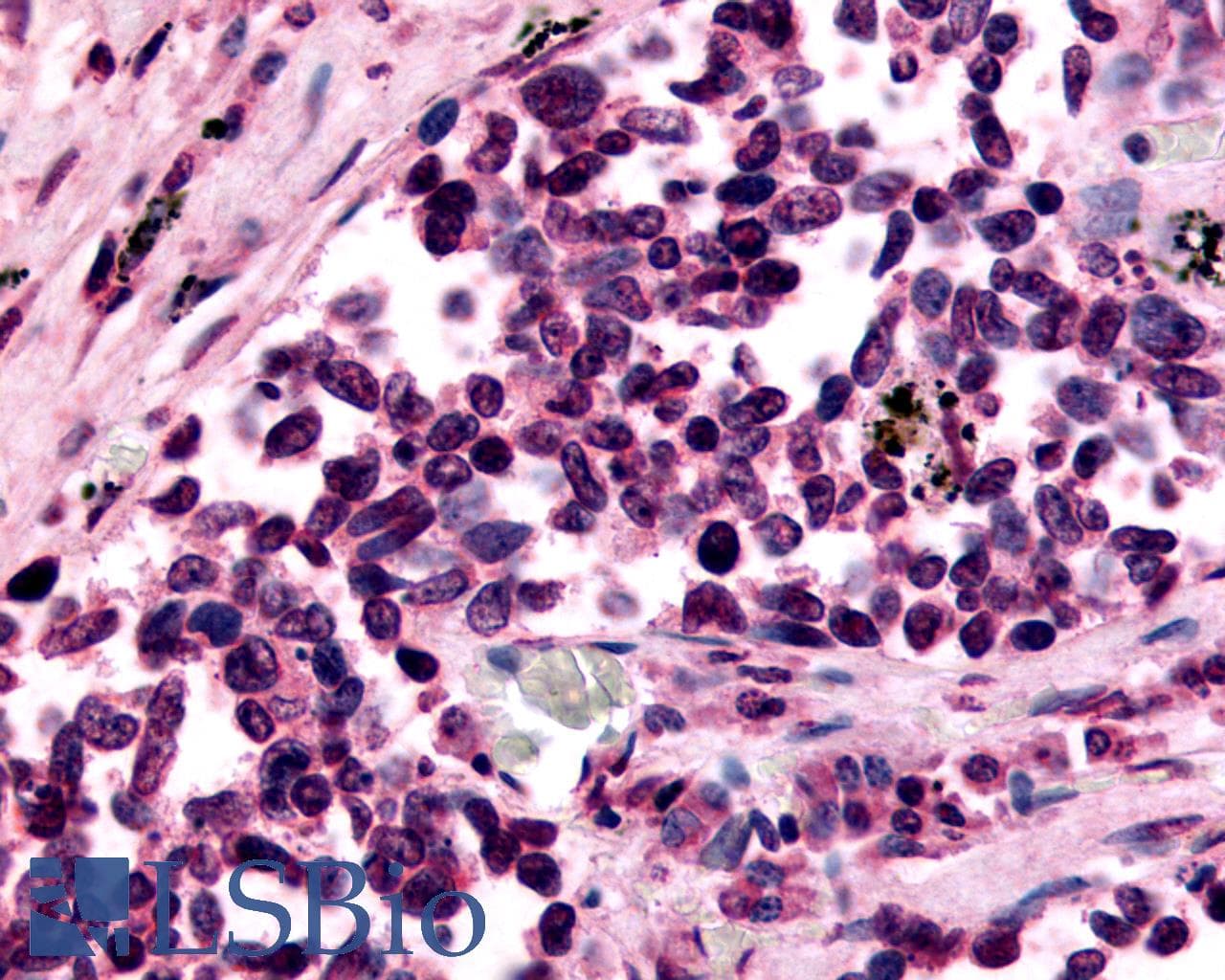 PathPlus™ Polyclonal Rabbit anti-Human GPR182 / ADMR Antibody (N-Terminus, IHC, WB)