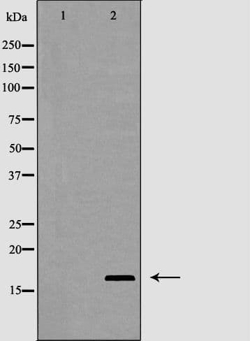 IL2 Antibody