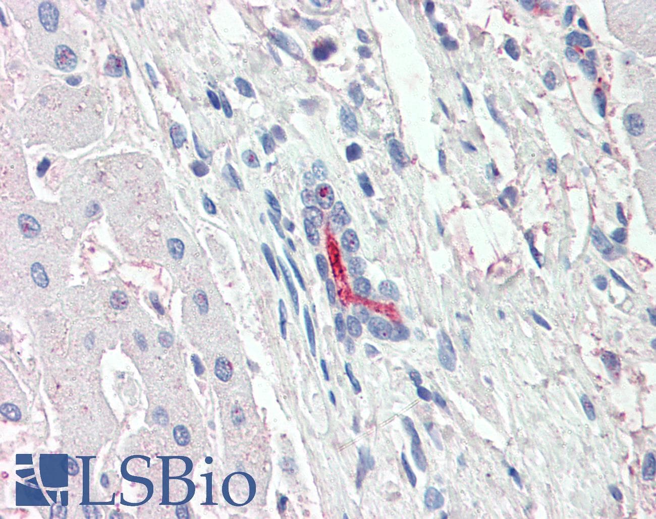 IHC-plus™ Polyclonal Rabbit anti-Human SLC5A1 / SGLT1 Antibody (Internal, IHC)