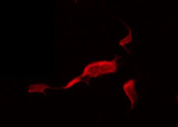 ADCK5 Antibody