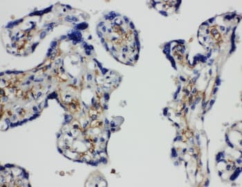 SNAP23 / SNAP-23 Antibody (aa192-211)